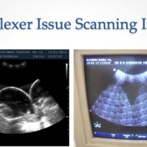 Multiplexer issue scanning images